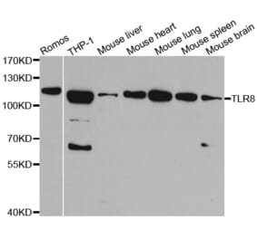 Western blot - TLR8 Antibody from Signalway Antibody (32289) - Antibodies.com