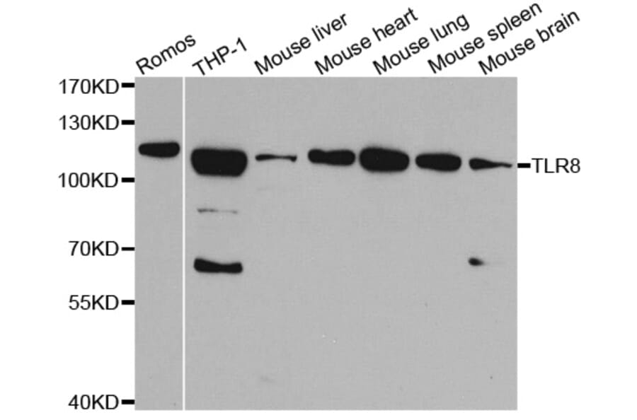 Western blot - TLR8 Antibody from Signalway Antibody (32289) - Antibodies.com