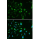 Immunofluorescence - TLR8 Antibody from Signalway Antibody (32289) - Antibodies.com