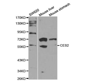 Western blot - CES2 Antibody from Signalway Antibody (32291) - Antibodies.com