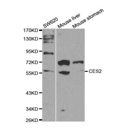 Western blot - CES2 Antibody from Signalway Antibody (32291) - Antibodies.com