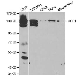 Western blot - UPF1 Antibody from Signalway Antibody (32298) - Antibodies.com