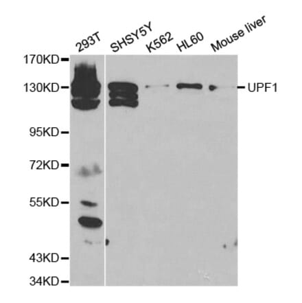 Western blot - UPF1 Antibody from Signalway Antibody (32298) - Antibodies.com