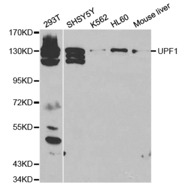 Western blot - UPF1 Antibody from Signalway Antibody (32298) - Antibodies.com