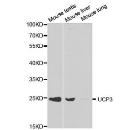 Western blot - UCP3 Antibody from Signalway Antibody (32300) - Antibodies.com