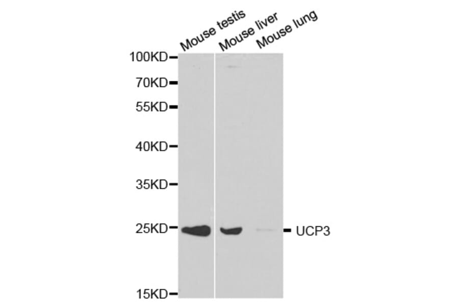 Western blot - UCP3 Antibody from Signalway Antibody (32300) - Antibodies.com