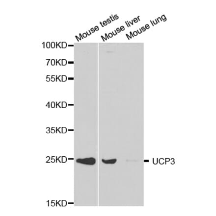 Western blot - UCP3 Antibody from Signalway Antibody (32300) - Antibodies.com