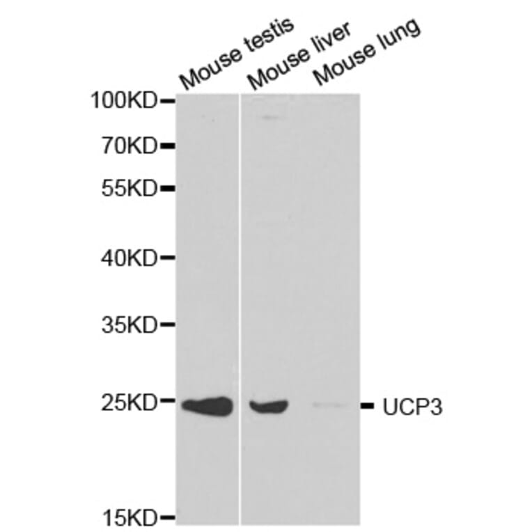 Western blot - UCP3 Antibody from Signalway Antibody (32300) - Antibodies.com