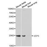 Western blot - UCP3 Antibody from Signalway Antibody (32300) - Antibodies.com