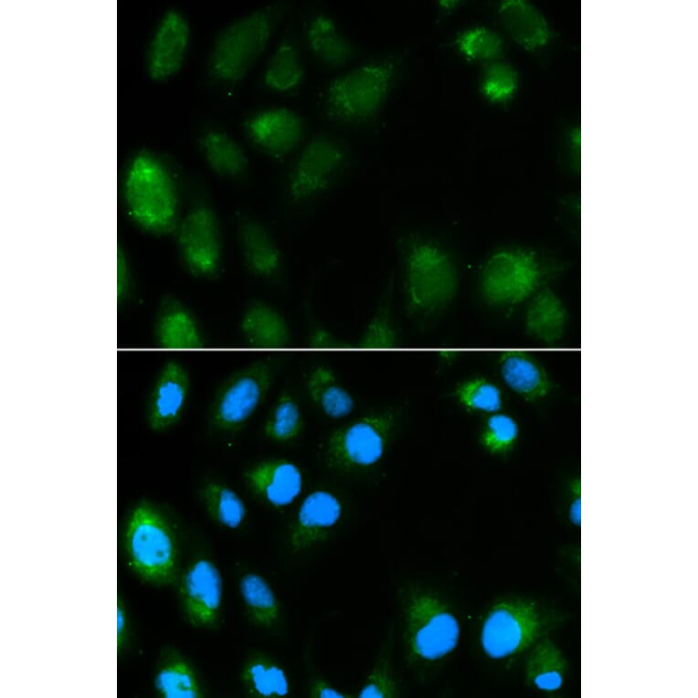 Immunofluorescence - UCP3 Antibody from Signalway Antibody (32300) - Antibodies.com