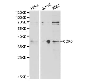 Western blot - CDK6 Antibody from Signalway Antibody (32305) - Antibodies.com