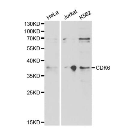 Western blot - CDK6 Antibody from Signalway Antibody (32305) - Antibodies.com