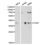 Western blot - CDK6 Antibody from Signalway Antibody (32305) - Antibodies.com