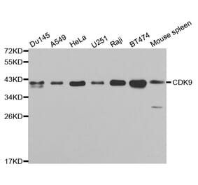 Western blot - CDK9 Antibody from Signalway Antibody (32311) - Antibodies.com