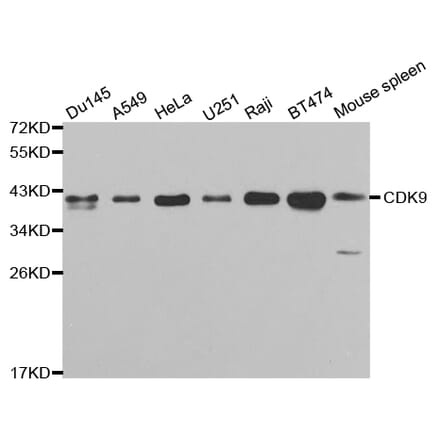 Western blot - CDK9 Antibody from Signalway Antibody (32311) - Antibodies.com