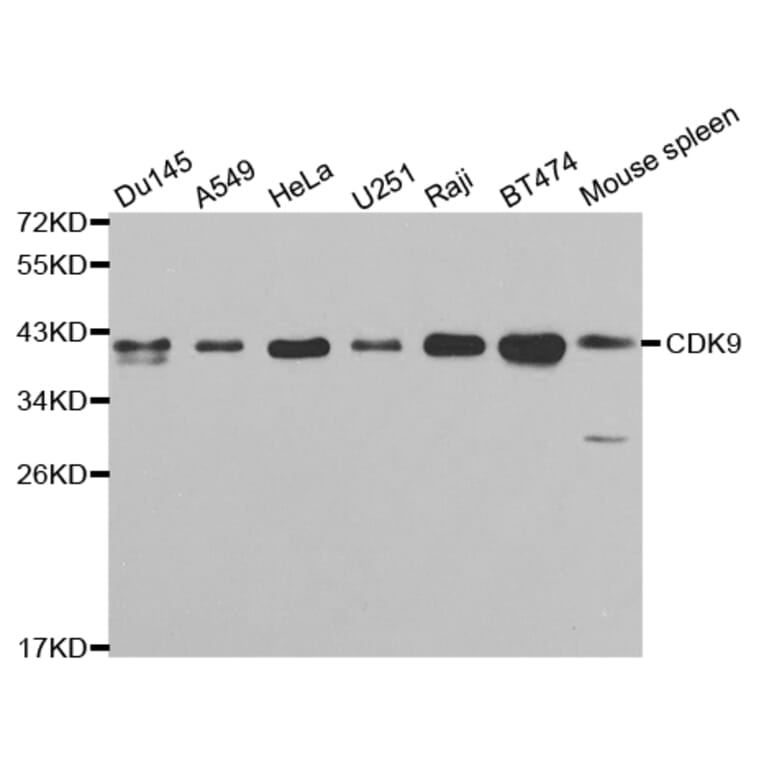 Western blot - CDK9 Antibody from Signalway Antibody (32311) - Antibodies.com