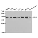 Western blot - CDK9 Antibody from Signalway Antibody (32311) - Antibodies.com