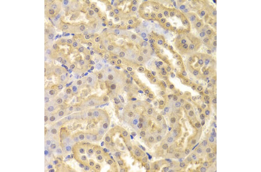 Immunohistochemistry - CDK9 Antibody from Signalway Antibody (32311) - Antibodies.com