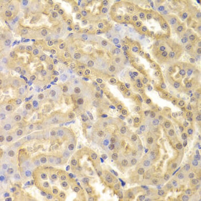 Immunohistochemistry - CDK9 Antibody from Signalway Antibody (32311) - Antibodies.com