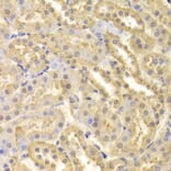 Immunohistochemistry - CDK9 Antibody from Signalway Antibody (32311) - Antibodies.com