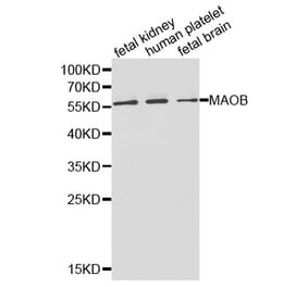 Western blot - MAOB Antibody from Signalway Antibody (32314) - Antibodies.com