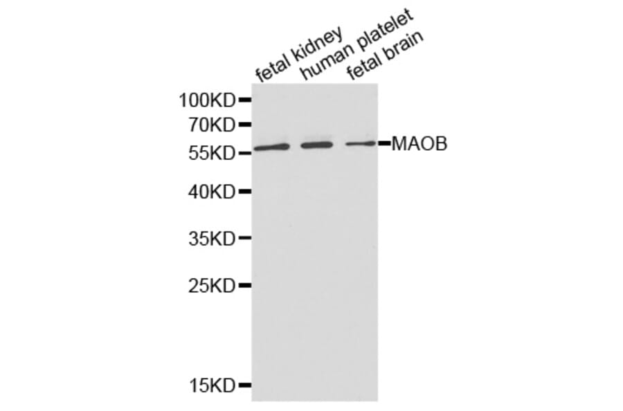Western blot - MAOB Antibody from Signalway Antibody (32314) - Antibodies.com