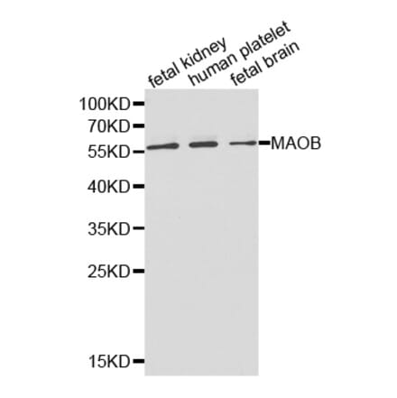 Western blot - MAOB Antibody from Signalway Antibody (32314) - Antibodies.com