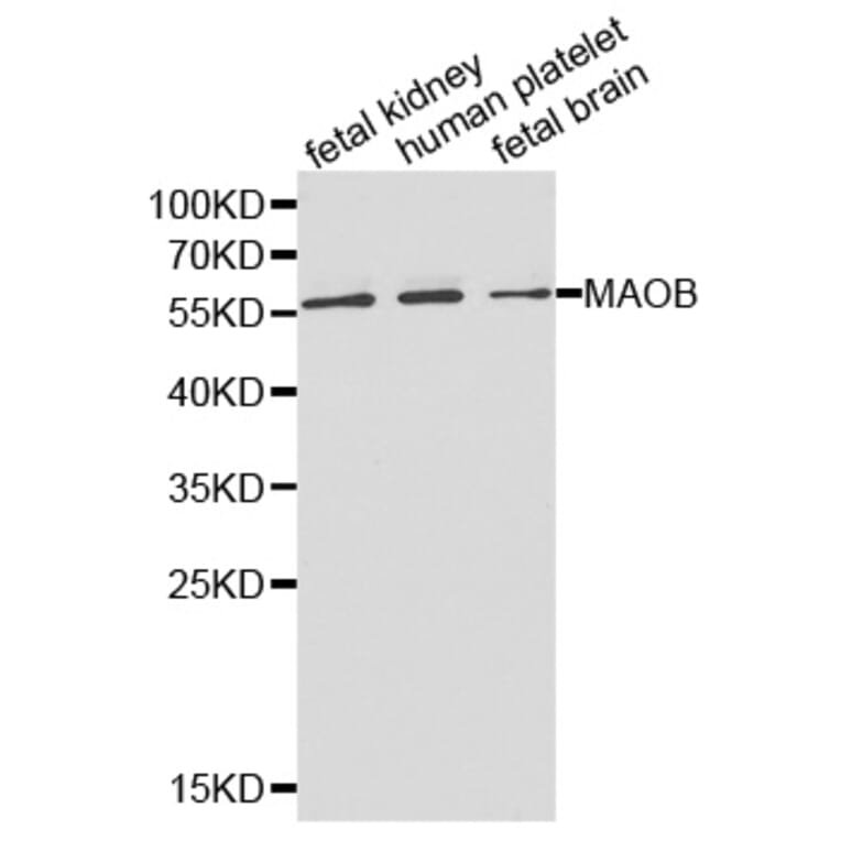 Western blot - MAOB Antibody from Signalway Antibody (32314) - Antibodies.com