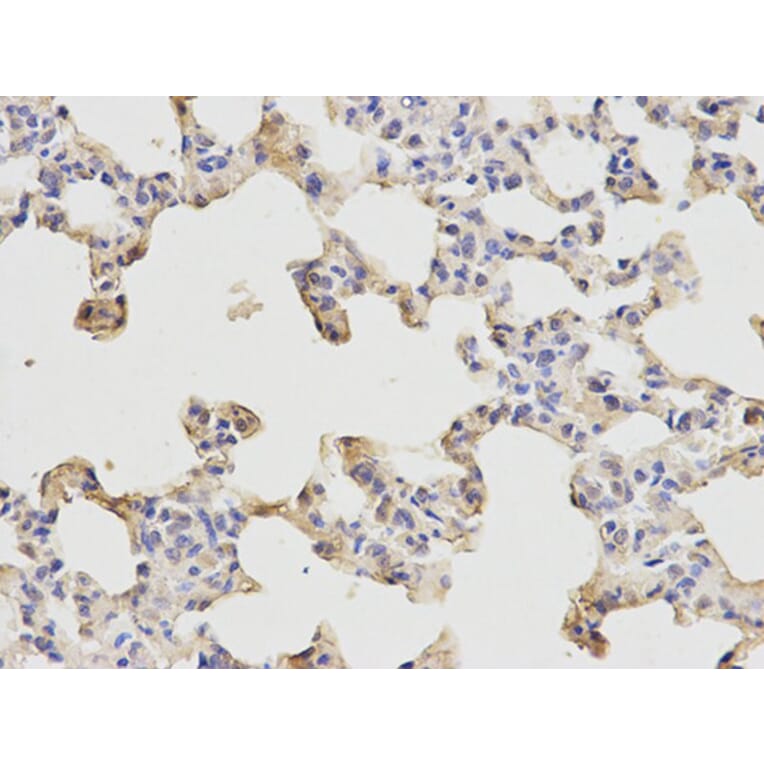 Immunohistochemistry - ETS1 Antibody from Signalway Antibody (32332) - Antibodies.com