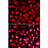 Immunofluorescence - ETS1 Antibody from Signalway Antibody (32332) - Antibodies.com