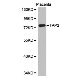 Western blot - TAP2 Antibody from Signalway Antibody (32339) - Antibodies.com