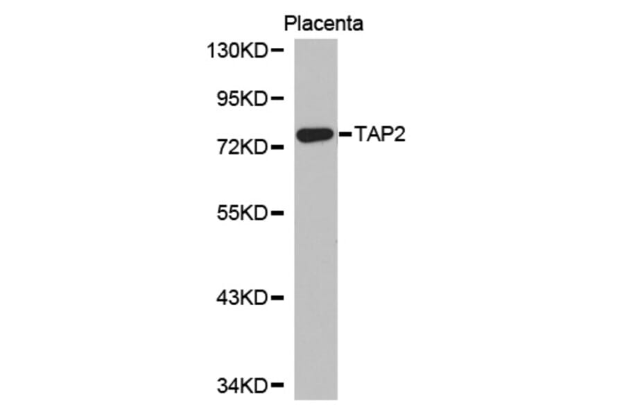 Western blot - TAP2 Antibody from Signalway Antibody (32339) - Antibodies.com
