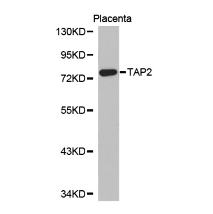 Western blot - TAP2 Antibody from Signalway Antibody (32339) - Antibodies.com