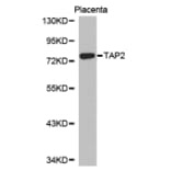 Western blot - TAP2 Antibody from Signalway Antibody (32339) - Antibodies.com
