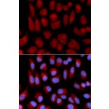 Immunofluorescence - TAP2 Antibody from Signalway Antibody (32339) - Antibodies.com