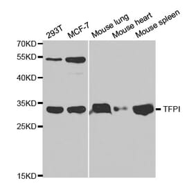 Western blot - TFPI Antibody from Signalway Antibody (32350) - Antibodies.com