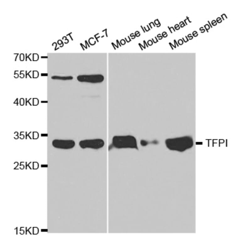 Western blot - TFPI Antibody from Signalway Antibody (32350) - Antibodies.com