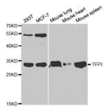 Western blot - TFPI Antibody from Signalway Antibody (32350) - Antibodies.com