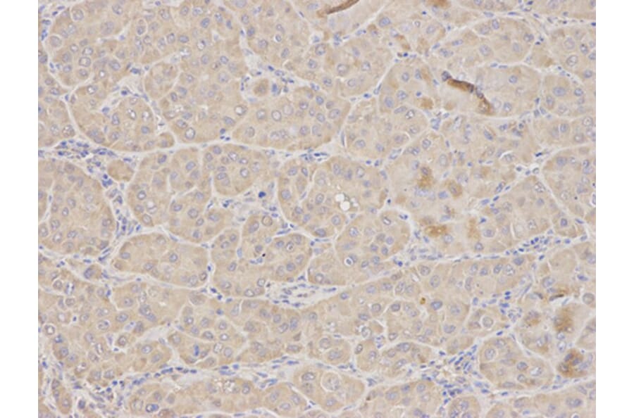 Immunohistochemistry - TFPI Antibody from Signalway Antibody (32350) - Antibodies.com