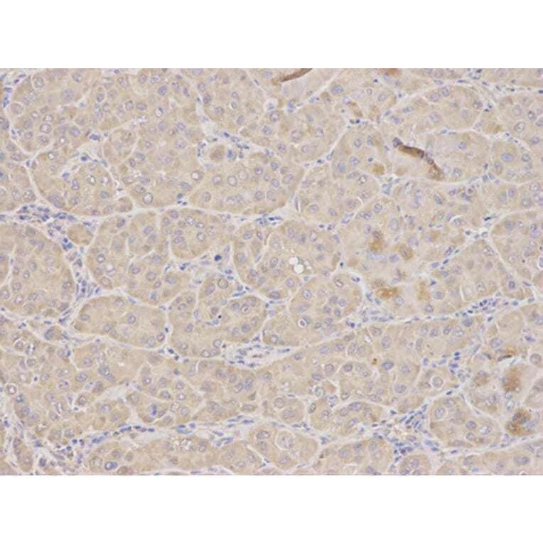 Immunohistochemistry - TFPI Antibody from Signalway Antibody (32350) - Antibodies.com