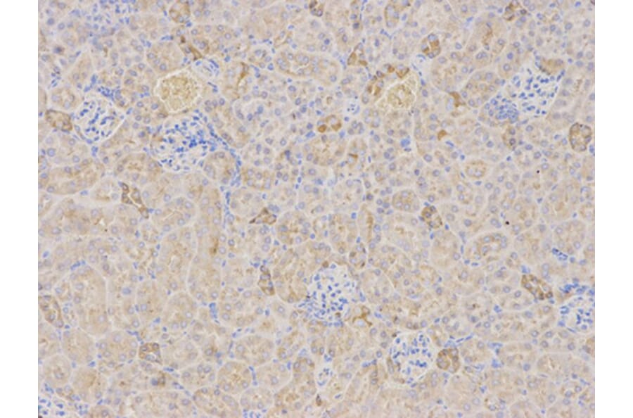 Immunohistochemistry - TFPI Antibody from Signalway Antibody (32350) - Antibodies.com
