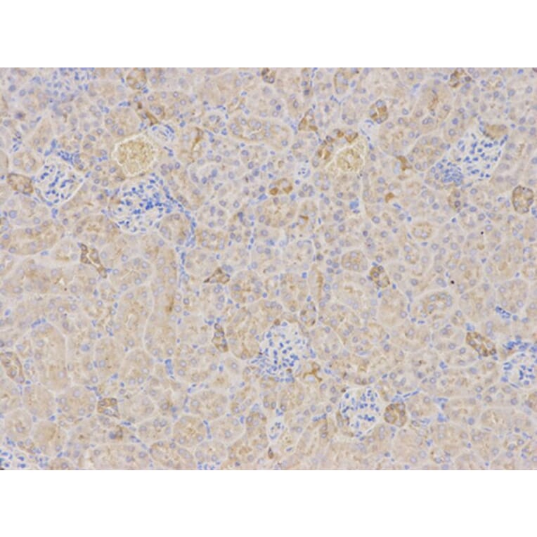 Immunohistochemistry - TFPI Antibody from Signalway Antibody (32350) - Antibodies.com