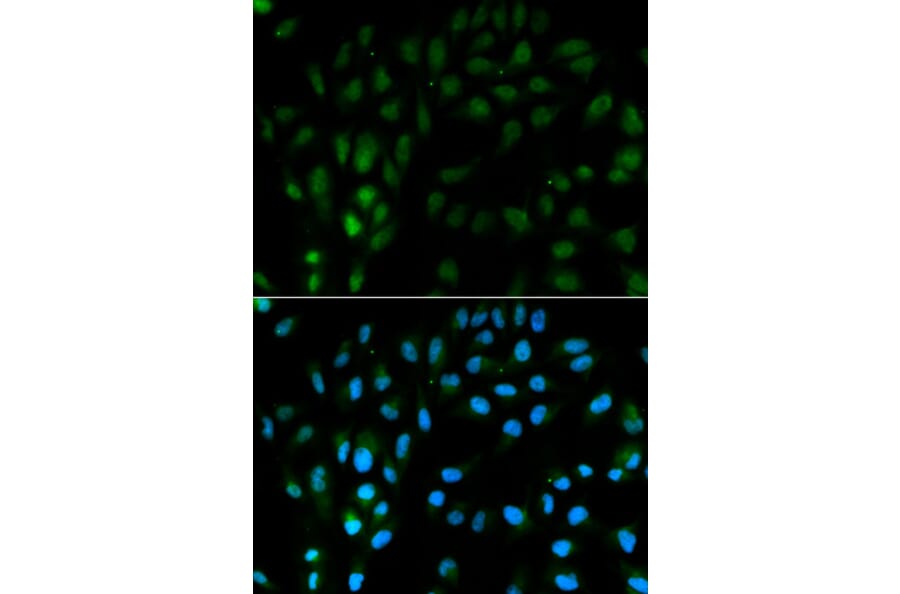 Immunofluorescence - TFPI Antibody from Signalway Antibody (32350) - Antibodies.com