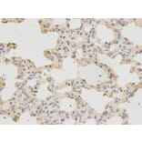 Immunohistochemistry - RFC1 Antibody from Signalway Antibody (32351) - Antibodies.com
