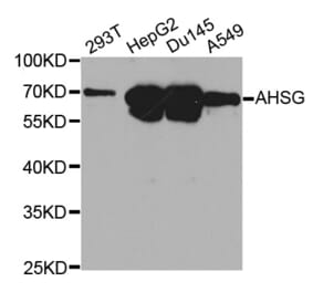 Western blot - AHSG Antibody from Signalway Antibody (32365) - Antibodies.com
