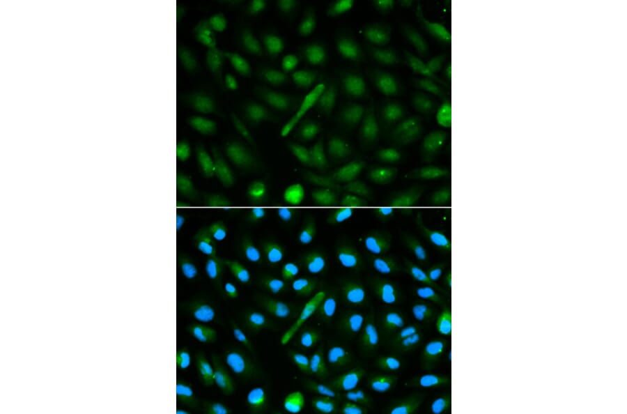 Immunofluorescence - AHSG Antibody from Signalway Antibody (32365) - Antibodies.com