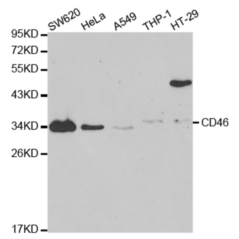 Western blot - CD46 Antibody from Signalway Antibody (32368) - Antibodies.com