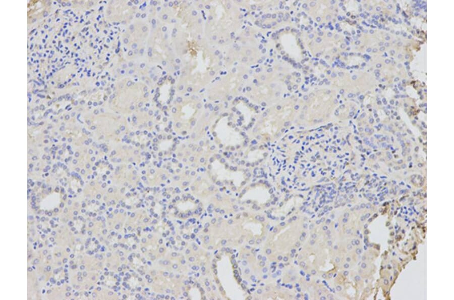 Immunohistochemistry - CD46 Antibody from Signalway Antibody (32368) - Antibodies.com