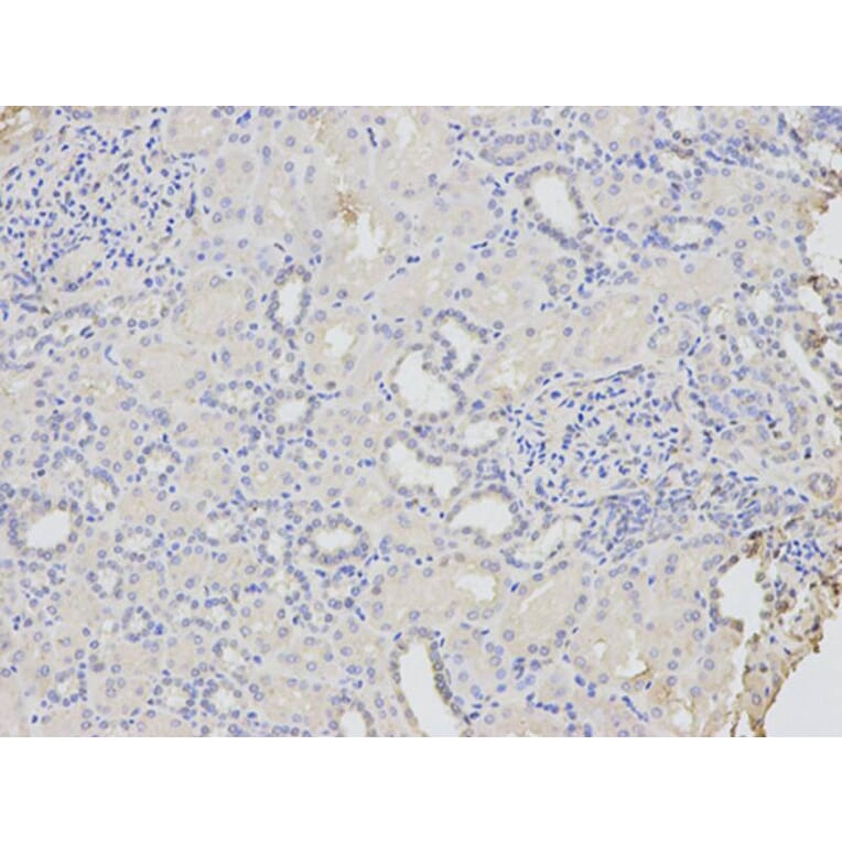 Immunohistochemistry - CD46 Antibody from Signalway Antibody (32368) - Antibodies.com