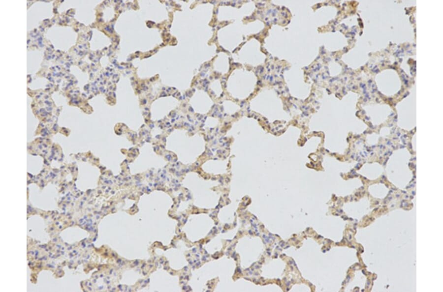 Immunohistochemistry - CD46 Antibody from Signalway Antibody (32368) - Antibodies.com